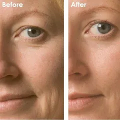 [Hàng chính hãng- Đủ VAT] Kem Dưỡng Phục Hồi Da Obagi Clinical Kinetin+ Hydrating Cream 50ml - Giảm Nếp Nhăn, Cấp Ẩm, Cải Thiện Tông Da, Phù Hợp Mọi Loại Da