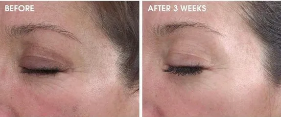 Serum Glowbiotics Advanced Retinol Renewal 30ml - Hỗ trợ trẻ hóa da, cải thiện nếp nhăn, da sáng mịn, phù hợp cho mọi loại da