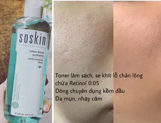 Nước Hoa Hồng Soskin Gentle Purifying Lotion 250ml - Chăm Sóc Da Dầu, Ngăn Ngừa Mụn, Làm Sạch Sâu, Cân Bằng Độ Ẩm
