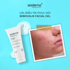 Gel điều tiết bã nhờn Sebovalis Facial Gel 50ml - Chăm sóc da dầu mụn, giảm viêm, ngăn ngừa mụn hiệu quả từ Sesderma