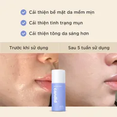 Gel Tẩy Tế Bào Chết AHA & PHA Candid 100ml - Hỗ Trợ Mịn Da, Ngừa Mụn, Dưỡng Sáng Da, Dạng Gel Dịu Nhẹ, Sản Phẩm Chăm Sóc Da Chất Lượng Cao