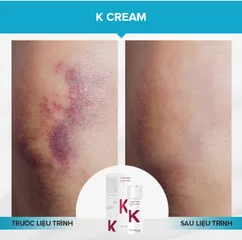 Kem hồi phục da nhạy cảm Dermica K Dermic Creme 30ml - Giảm sưng, làm dịu da sau xâm lấn, phục hồi da khỏe mạnh.
