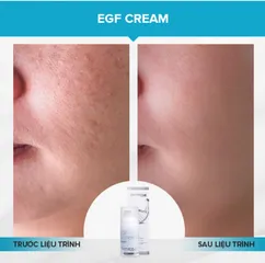 Kem tái tạo và làm mờ sẹo Dermica EGF 30ml - Hỗ trợ phục hồi da, giảm sẹo rỗ, công nghệ sinh học tiên tiến