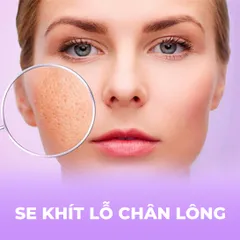 Tinh Chất BHA20 Peel Radiance Beauva - Hỗ Trợ Se Khít Lỗ Chân Lông, Làm Mờ Thâm, Dưỡng Da Mịn Màng, 60ml