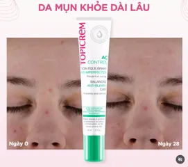 Kem Dưỡng Ẩm Cho Da Mụn Topicrem AC Control 40ml - Gel Cân Bằng Chống Mụn, Cấp Ẩm, Giữ Ẩm Cho Da Dầu và Hỗn Hợp