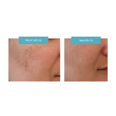 Kem Dưỡng Trắng Da Md:ceuticals md:Tranex Retipeel Whitening 50ml - Giúp Làm Đều Màu Da, Tươi Sáng, Mịn Màng, Phù Hợp Mọi Loại Da