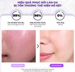Tinh chất ốc sên Tiam Snail & Azulene Essence 180ml - Serum làm dịu và phục hồi da nhạy cảm, cấp ẩm tự nhiên hiệu quả