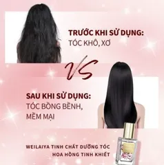Tinh Dầu Dưỡng Tóc Weilaiya Đức Chiết Xuất Cánh Hoa Hồng - Phục Hồi Tóc Hư Tổn, Giúp Tóc Bóng Mượt, Phù Hợp Với Tóc Khô Xơ