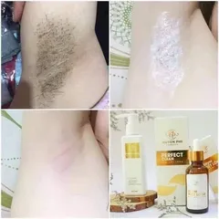 Kem Tẩy Lông Huyền Phi - Sản Phẩm Chính Hãng Giúp Triệt Lông Mềm Mại, An Toàn và Hiệu Quả Cho Da