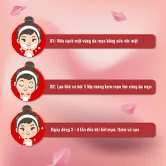 Kem trị mụn Acnevir đỏ - Giảm mụn đầu đen, đầu trắng - Chiết xuất tự nhiên, an toàn cho da nhờn - Tuýp 50gr