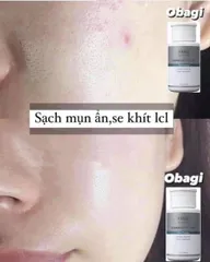 (Có tem) BHA 2% ngừa mụn, giảm dầu nhờn, thu nhỏ lỗ chân lông Obagi