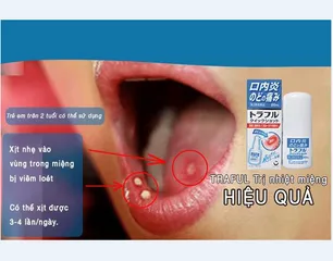 Xịt Giảm Đau Nhiệt Miệng Traful 20ml - Chăm Sóc Răng Miệng Nhật Bản, Hiệu Quả Giảm Đau Lở Miệng, Dễ Sử Dụng