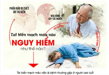 Viên uống hỗ trợ tai biến mạch máu não Orihiro Nattokinase 2000FU 60 viên - Giảm nguy cơ tai biến, cải thiện trí nhớ, sức khỏe tốt hơn.