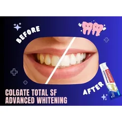 Kem Đánh Răng Colgate Total Advanced Whitening 181g Mỹ, Kem Đánh Răng Colgate Mỹ