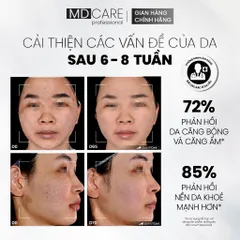 Sữa Rửa Mặt MD Care Mandelic 5% Gel Cleanser - Tẩy Tế Bào Chết Nhẹ Nhàng, Sạch Sâu, Phù Hợp Mọi Loại Da 30ml