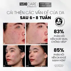Sữa Rửa Mặt Bọt MD CARE BHA 200ml - Chăm Sóc Da Dầu Mụn Nhạy Cảm, Giúp Làm Sạch Sâu và Ngăn Ngừa Mụn