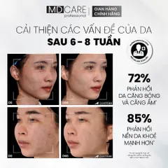 Sữa Rửa Mặt MD CARE Dưỡng Ẩm Dịu Nhẹ Cho Da Nhạy Cảm 200ml - Chứa Nano-Ceramide, Hyaluronic Acid, Giúp Làm Sạch Sâu, Cấp Ẩm Chuyên Sâu