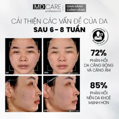 Tẩy Tế Bào Chết MD Care Glow Exfo 30ml - Làm Sáng, Mờ Thâm, Đều Màu Da với 10% Mandelic Acid & Glycolic Acid
