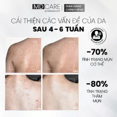 Xịt Tẩy Tế Bào Chết Toàn Thân MD CARE 100ml - Xịt Dưỡng Da AHA/BHA Giúp Loại Bỏ Mụn, Thâm, Và Cải Thiện Kết Cấu Da