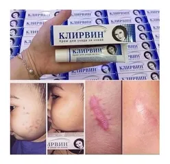 Kem Mờ Sẹo Klirvin Nga 25g - Giúp Làm Mờ Sẹo, Rạn Da & Quầng Thâm, Chiết Xuất Thiên Nhiên, Dưỡng Ẩm & Tái Tạo Da