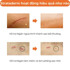 Kem Strataderm Thụy Sĩ - Gel Hỗ Trợ Cải Thiện Sẹo Lồi, Mờ Sẹo Lâu Năm, An Toàn Cho Cả Người Lớn Và Trẻ Em