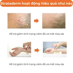 Kem Strataderm Thụy Sĩ - Gel Hỗ Trợ Cải Thiện Sẹo Lồi, Mờ Sẹo Lâu Năm, An Toàn Cho Cả Người Lớn Và Trẻ Em