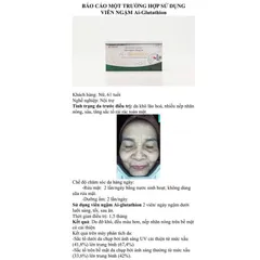Viên Ngậm Trắng Da AI Glutathion Cosvia Làm Sáng Da Bật Tông, Ngăn Ngừa Nám, Tàn Nhang, Lão Hoá - 30 Viên
