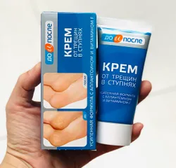 Kem Dưỡng Da Chân Giảm Nứt Gót Chân KPEM - Sản Phẩm Chăm Sóc Da Hiệu Quả Từ Apteka, Xuất Xứ Nga