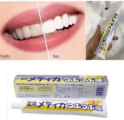 Kem Đánh Răng Muối Sunstar Nhật Bản 170g - Bảo Vệ Nướu, Trắng Răng, Hơi Thở Thơm Mát, Ngăn Ngừa Viêm Nướu