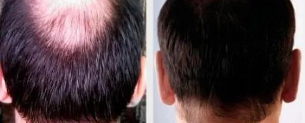 Ảnh đánh giá Viên uống Strong Hair hỗ trợ chống rụng tóc, cải thiện tóc yếu - Sản phẩm thiên nhiên từ Học viện Quân Y, 30 viên