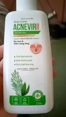 Ảnh đánh giá Sữa Tắm Acnevir 210ml - Giúp Cải Thiện Mụn Lưng, Viêm Nang Lông, Làn Da Sáng Mịn Từ Thiên Nhiên - Sản Phẩm Dược Mỹ Phẩm SANTAFA