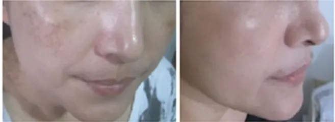 Ảnh đánh giá Kem dưỡng trắng phục hồi Sakura Spots Care Brightening Cream