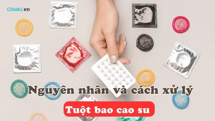 Tuột bao cao su: Nguyên nhân và cách xử lý kịp thời nhất