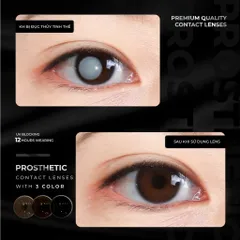Kính áp tròng thẩm mỹ Angel Eyes - Lens che khuyết điểm cho mắt bị đục thủy tinh thể, cườm, thiết kế thời trang Hàn Quốc