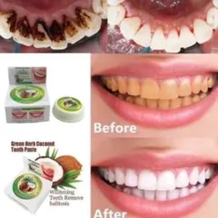 Kem Tẩy Trắng Răng Green Herbal Novolife Thái Lan - Gel Làm Sáng Răng, Loại Bỏ Ố Vàng, Hơi Thở Thơm Mát, An Toàn, Hiệu Quả Sau 14 Ngày