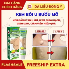 Kem Bôi Tan U Mỡ Thảo Mộc Sumifun - Giảm Sưng Đau, Loại Bỏ U Lớn, Da Khỏe Mạnh Tự Nhiên, Chiết Xuất 9 Loại Thảo Mộc Quý