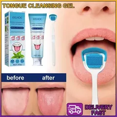 Bộ Vệ Sinh Lưỡi - Bàn Chải Đánh Lưỡi Kèm Gel Làm Sạch, Khử Mùi Miệng, Hơi Thở Thơm Mát Cho Chăm Sóc Răng Miệng Tốt Nhất