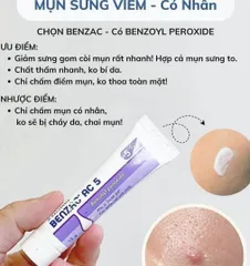 ✨ Kem Benzac AC 5% hỗ trợ giảm mụn hiệu quả chính hãng tuýp 15g
