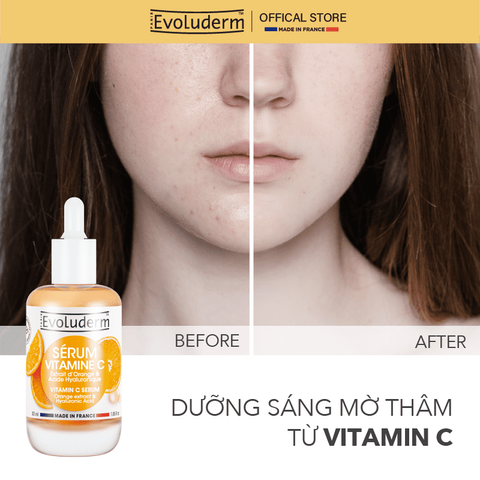 Serum Vitamin C Evoluderm 30ml - Tinh Chất Dưỡng Da Sáng Mịn, Chống Oxy Hóa, Dành Cho Mọi Loại Da, Thiên Nhiên, Thuần Chay