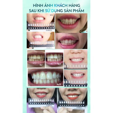 Miếng Dán Hỗ Trợ Trắng Răng Bạc Hà Anriea - Giúp Làm Trắng Răng, Khử Mùi Hôi và Thơm Miệng - Hộp 7 Miếng Dùng Thử