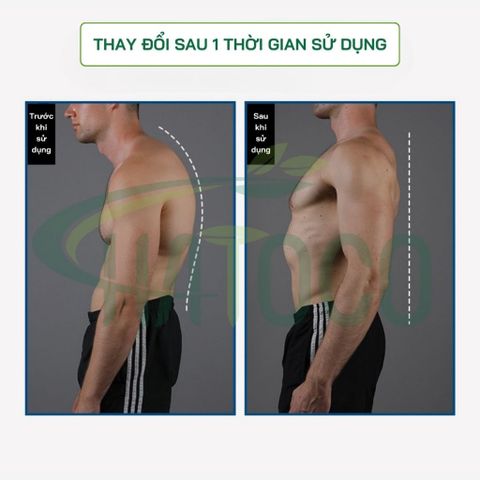 Đai Lưng Chống Gù Y Tế Hatoco Cao Cấp - Cải Thiện Tư Thế, Giảm Đau Lưng, Thoáng Khí, Hỗ Trợ Định Hình Cột Sống Cho Nam Nữ