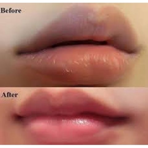 Dưỡng Môi Collagen Thiên Di - Khử Thâm & Làm Hồng Môi Tự Nhiên, Mềm Mịn, Không Hương Liệu, Dinh Dưỡng Từ Tinh Dầu Thiên Nhiên