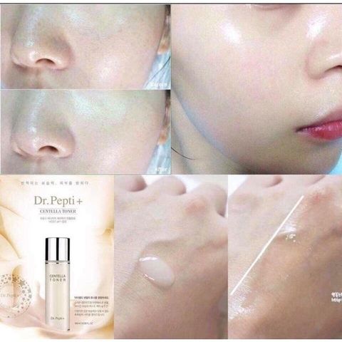 Nước Hoa Hồng Centella Dr.Pepti Ex Hàn Quốc Mẫu Mới 180ml Cấp Ẩm Căng Bóng Da