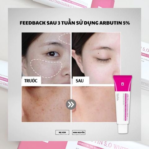 Kem Dưỡng Trắng Da Arbutin 5.0 Tosowoong 50ml - Làm Trắng, Mờ Nám, Chống Lão Hóa, Dưỡng Ẩm Da Tự Nhiên Hàn Quốc