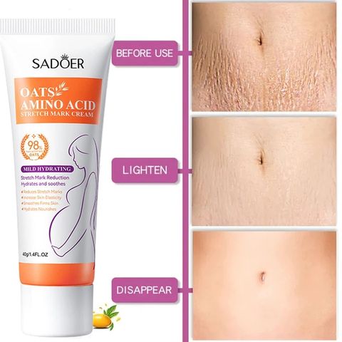 Kem Làm Mờ Rạn Da Anti-Stretch Marks Cream Cho Bà Bầu - Giúp Tái Tạo Da, Giảm Sẹo và Thâm, An Toàn Cho Làn Da Nhạy Cảm