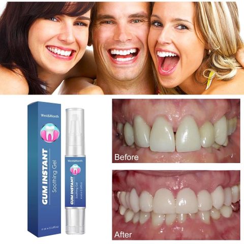 Bút Tẩy Trắng Răng Nha Khoa TEETH Whitening Pen - Giúp Làm Sạch Mảng Bám, Răng Trắng Sáng Tự Nhiên, Tiện Lợi và An Toàn
