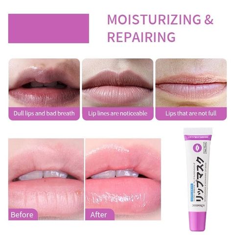 Dưỡng Hồng Môi KORMESIC 15ML – Mặt Nạ Ngủ Môi Lip Mask Dưỡng Ẩm, Làm Hồng Môi, Giúp Môi Mềm Mại và Tươi Sáng