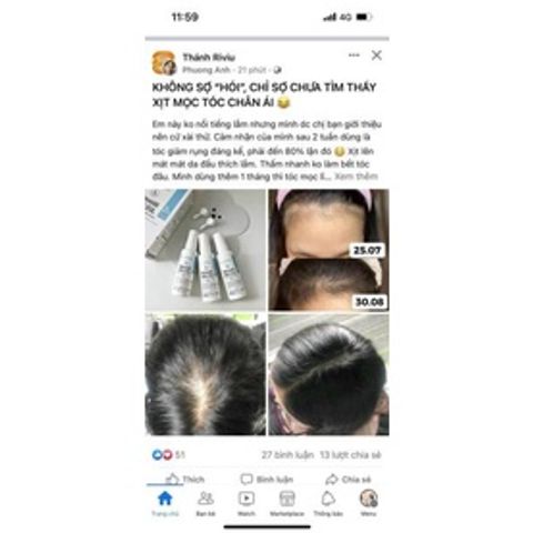 Xịt mọc tóc Minoxidil 5% BAILLEUL - Giảm rụng tóc, kích thích mọc tóc hiệu quả cho nam và nữ - Best Seller Pháp