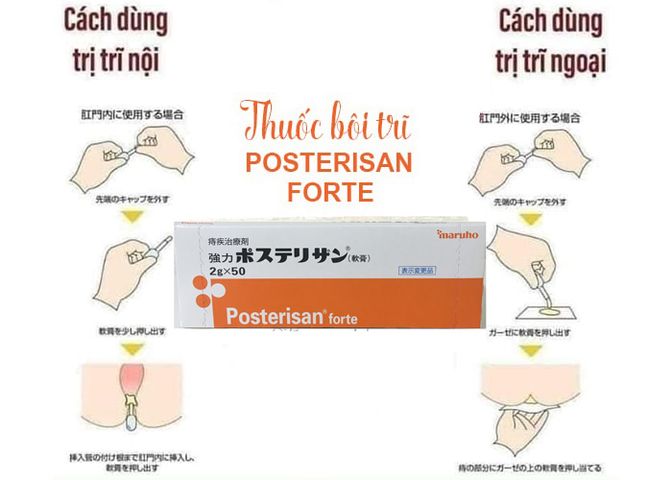 Kem Bôi Trĩ Nhật Bản Posterisan Forte - Giảm Đau Rát, Chăm Sóc Da Hậu Môn - Hộp 50 Tuýp Tiện Lợi