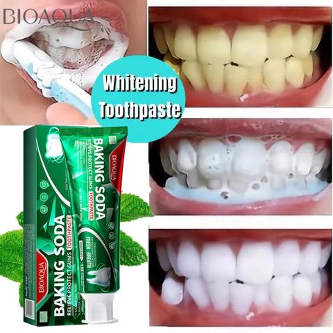 Kem Đánh Răng Baking Soda Toothpaste 100g - Làm Trắng Răng, Loại Bỏ Cao Răng, Hơi Thở Thơm Mát, Chăm Sóc Sức Khỏe Răng Miệng